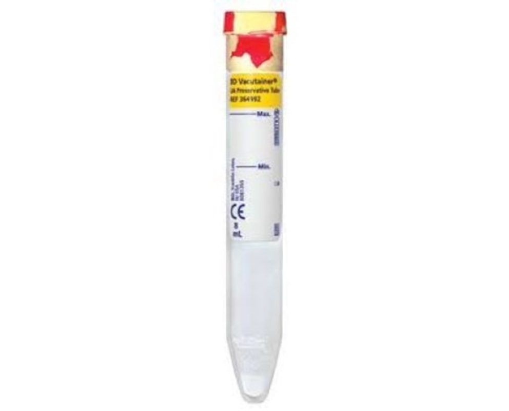 bd-364992-vacutainer-urinalysis-tubes-conical-bottom-w-preservative